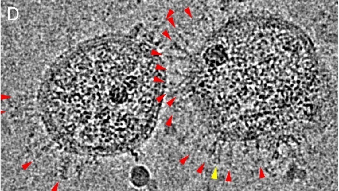 El virus SARS-CoV-2 captado con un microscopio electrónico Cryo-EM, que analiza muestras a temperaturas criogénicas.