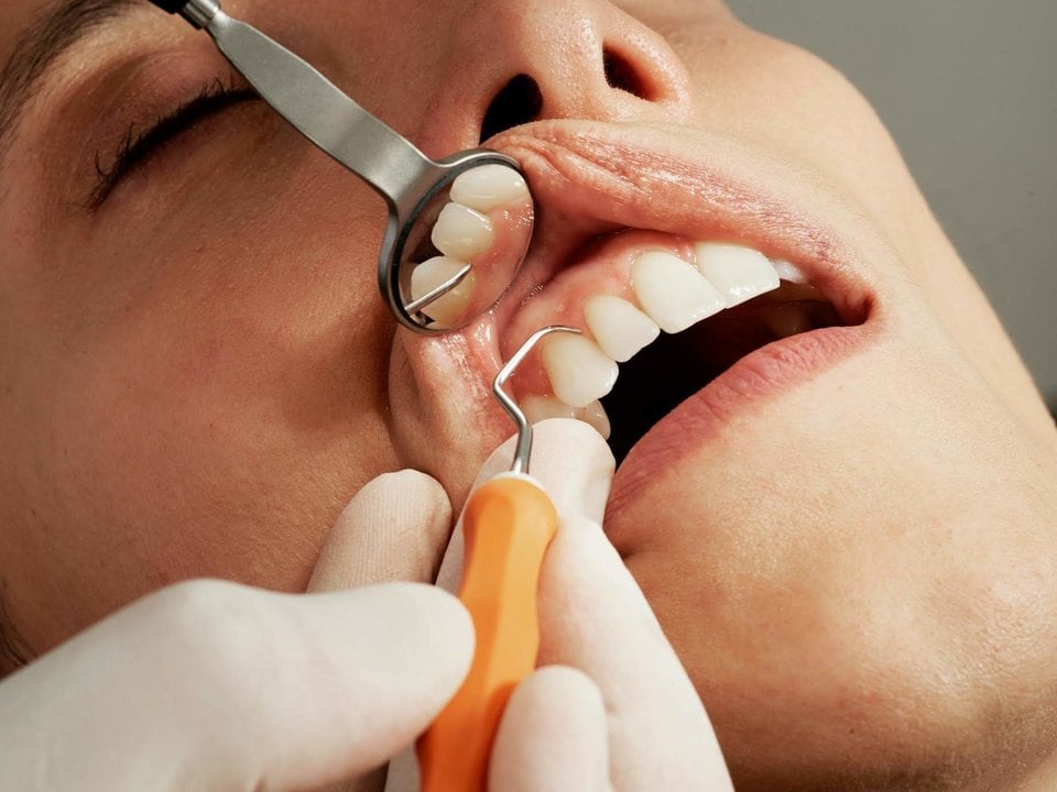 Los problemas dentales más comunes, ¿tienes alguno de ellos?